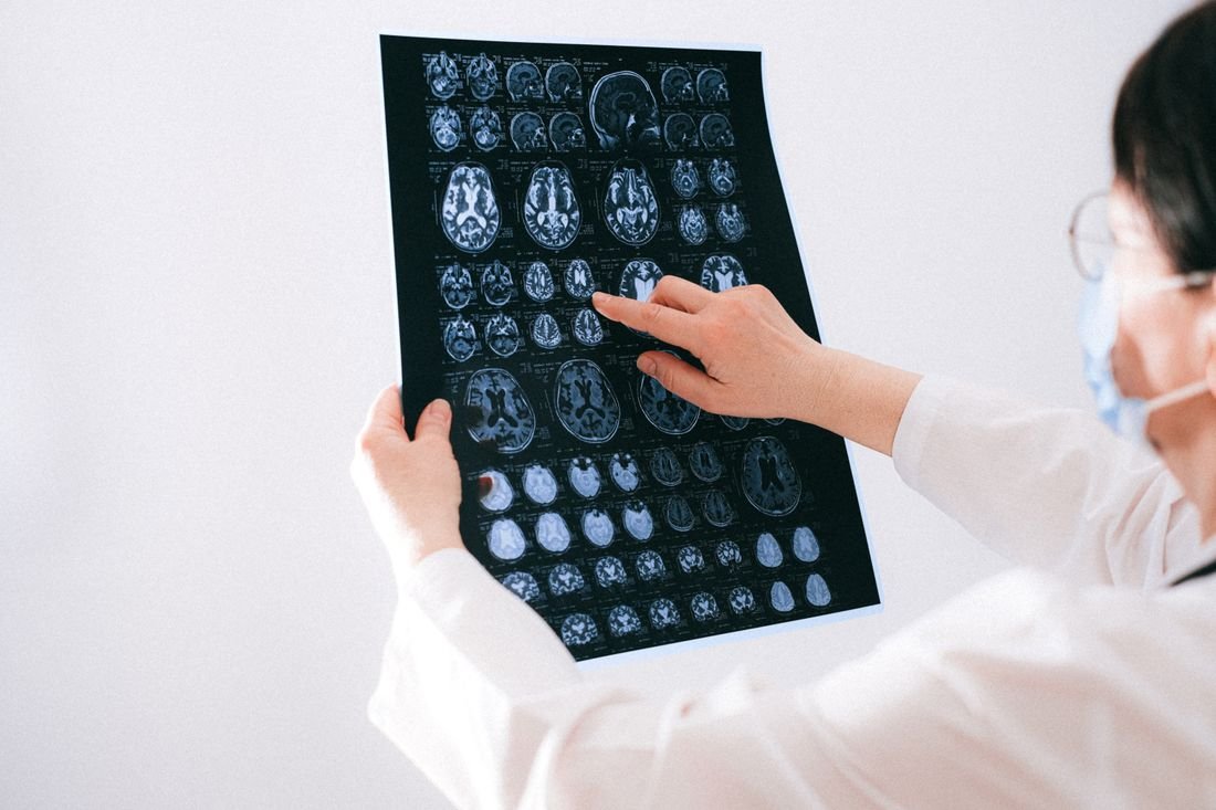 Illustrative medical photograph